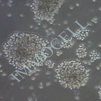 NK-92人恶性非霍奇金淋巴瘤患者的自然杀伤细胞 价格丨nk92细胞系丨逸漠(immocell)