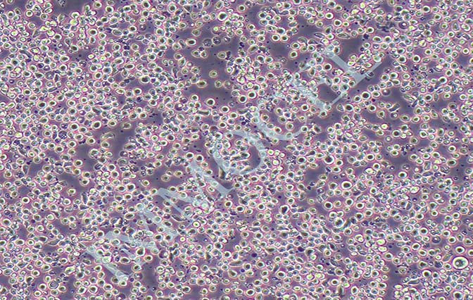 CEM/C1人急性淋巴细胞白血病细胞丨[CEM/C1]细胞