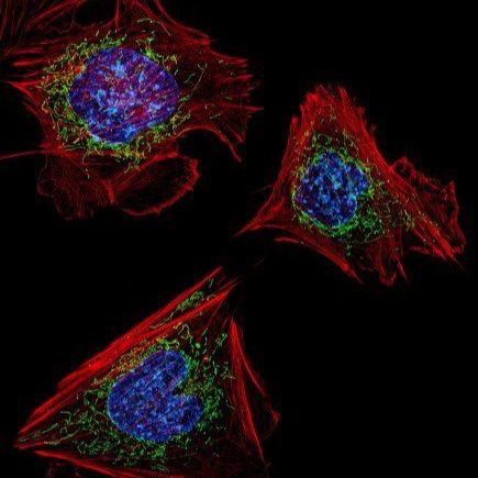 P19小鼠畸胎瘤细胞P19、P19