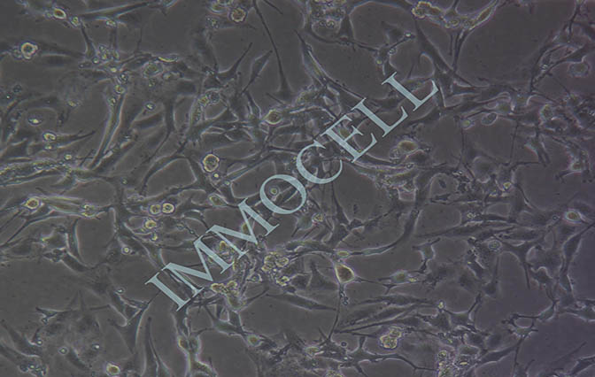 U-87MG人脑星形胶质母细胞瘤丨u87mg 细胞(STR鉴