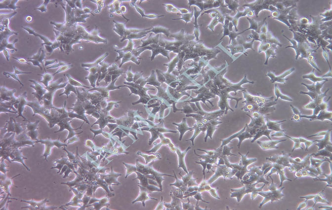 22Rv1人前列腺癌细胞丨22rv1细胞丨[22rv1]