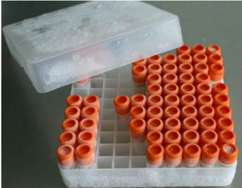 细胞耗材如何清洗？这些步骤不能少