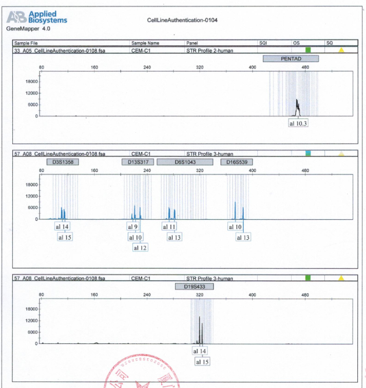 CEM/C1人急性淋巴细胞白血病细胞丨[CEM/C1]细胞