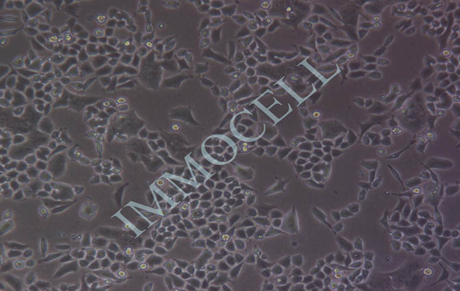 HCT-8人回盲肠癌细胞