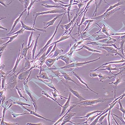 U-118 MG人脑星形胶质母细胞瘤丨U-118 MG细胞株(STR鉴定)
