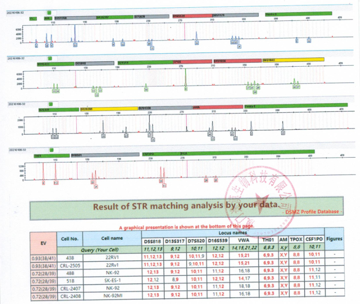 22Rv1人前列腺癌细胞丨22rv1细胞丨[22rv1]