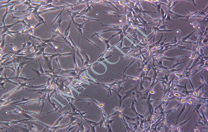 U-87MG人脑星形胶质母细胞瘤丨u87mg 细胞(STR鉴