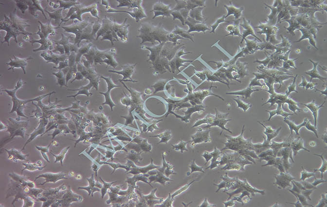 22Rv1人前列腺癌细胞丨22rv1细胞丨[22rv1]