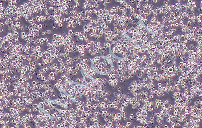 CEM/C1人急性淋巴细胞白血病细胞丨[CEM/C1]细胞