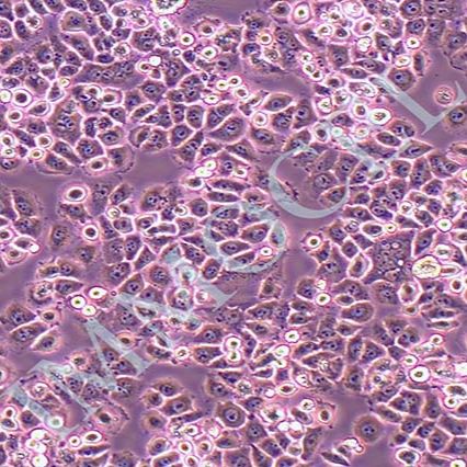 SBC-2人小细胞肺癌(STR鉴定)丨SBC-2细胞系