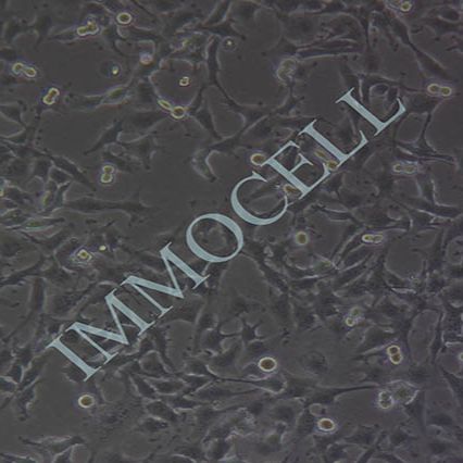 MUM2B人侵袭性脉络膜黑色素瘤细胞(含STR)丨MUM2B细胞株