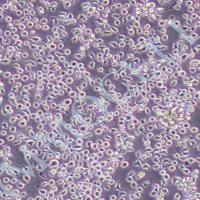 MAC-1人皮肤T淋巴瘤细胞