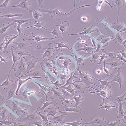 U251MG人类星型胶质细胞瘤丨U251MG细胞
