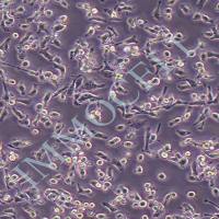 MFC小鼠前胃癌细胞丨MFC细胞株