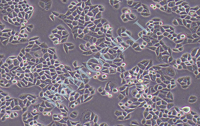 RwPE-2(人前列腺正常细胞)丨RwPE-2细胞株(STR