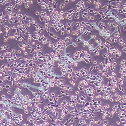 RAW 264.7小鼠单核巨噬细胞白血病细胞丨RAW 264.7细胞株