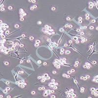 SK-MEL-1人皮肤黑色素瘤细胞丨SK-MEL-1细胞株(含STR)丨SK-MEL-1