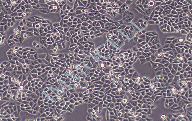 RwPE-2(人前列腺正常细胞)丨RwPE-2细胞株(STR