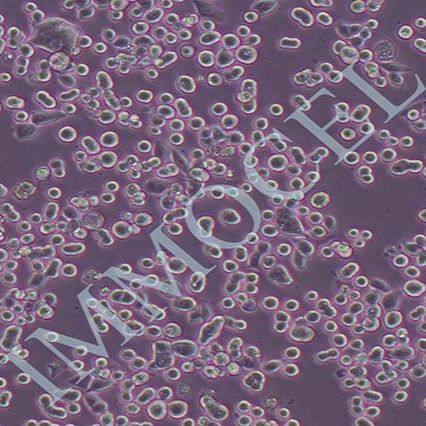 KATO III 人胃癌细胞丨KATO III 细胞株(STR鉴定)