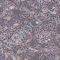 B16-F10小鼠黑色素瘤细胞价格丨b16-f10细胞购买