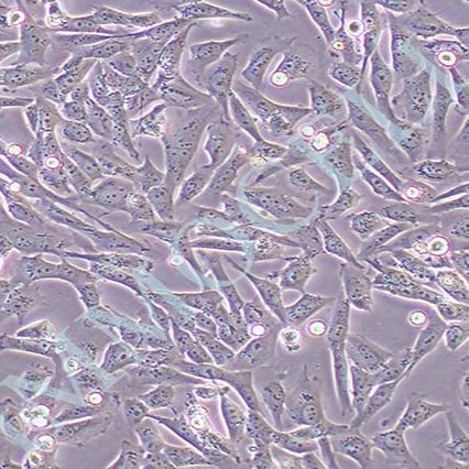 SF188人胶质母细胞瘤细胞（STR鉴定）