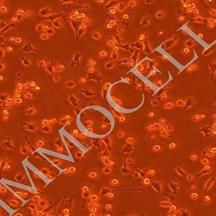 NCTC1469小鼠正常肝细胞丨NCTC1469细胞株丨逸漠(immocell)