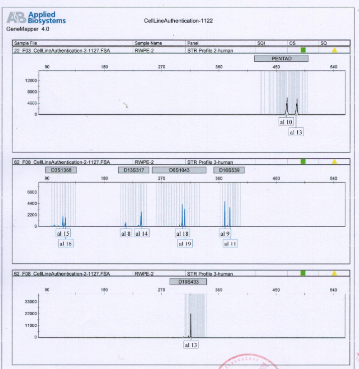 RwPE-2(人前列腺正常细胞)丨RwPE-2细胞株(STR