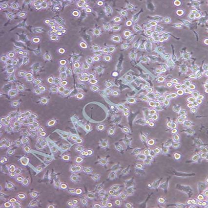 NR8383大鼠肺泡巨噬细胞丨NR8383细胞株丨逸漠(immocell)