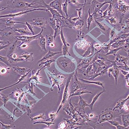 U251 MG/TMZ人类星形胶质瘤耐替莫唑胺耐药株细胞丨u251mg 细胞