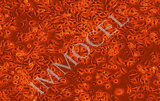 E0771小鼠乳腺癌细胞