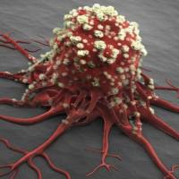 769-P-GFP 人肾细胞腺癌细胞-绿色标记