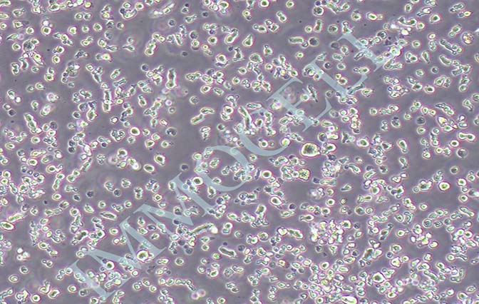 MM.1S人IGA-骨髓瘤细胞
