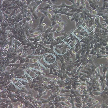HEPA1-6 小鼠肝癌细胞丨hepa1-6细胞培养
