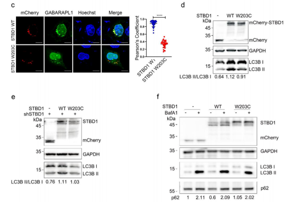 12+:预测癌症中改变自噬的基因突变