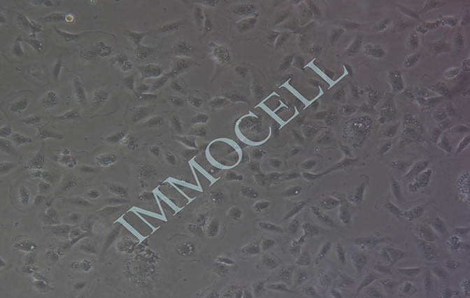 T24/DDP人膀胱癌顺铂耐药株