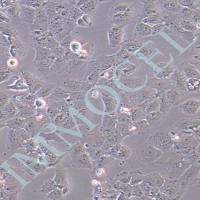 人乳腺癌阿霉素耐药株 MCF-7/ADR 价格丨MCF-7 细胞厂家