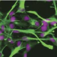 C918-GFP 人眼脉络黑色素瘤细胞-绿色标记