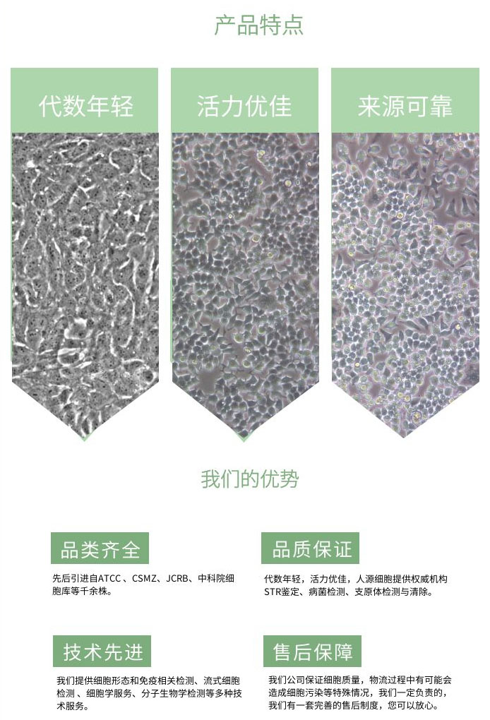 鸭胚胎成纤维细胞(永生化)