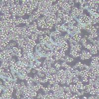 人B淋巴白血病细胞+LUC Nalm6-puro