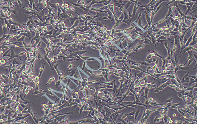 RM-1+LUC小鼠前列腺癌细胞-荧光素酶标记
