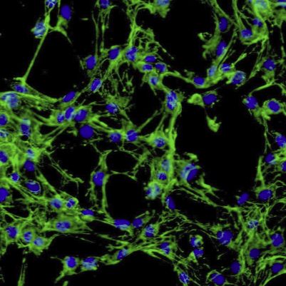 hct116/L-GFP 人结肠癌耐奥沙利铂细胞株-绿色标记