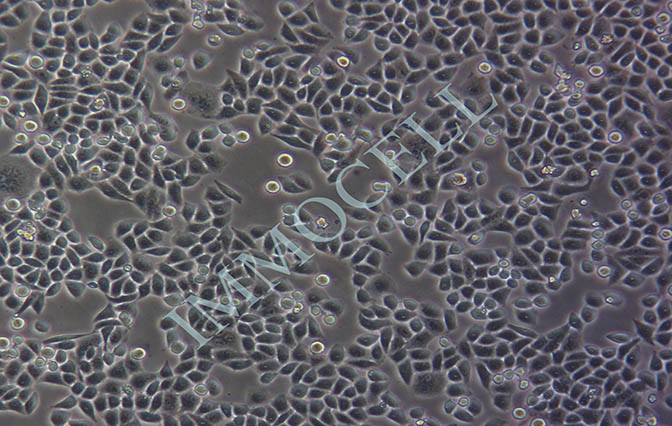 Eca-109人食管癌细胞