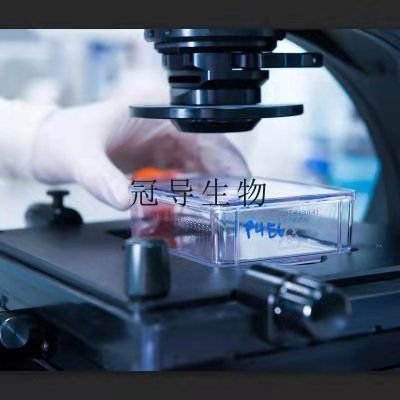 CHO/dhFr- Cells;二氢叶酸还原酶缺陷型中国仓鼠卵巢活化克隆细胞|STR鉴定图谱