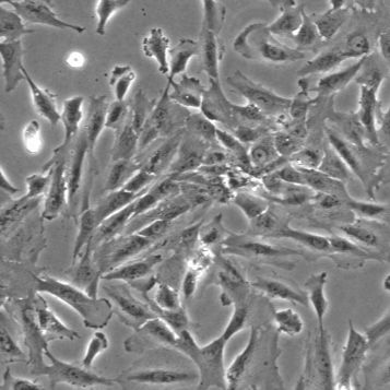 U87MG-LUC 人恶性胶质母细胞瘤细胞