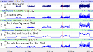 人体肌电测量系统，人体肌电测量仪