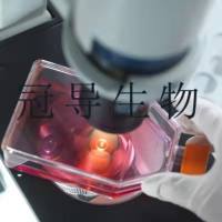 ES2 Cells;人卵巢癌活化克隆细胞|STR鉴定图谱