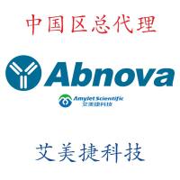 Magnetic Bead Carboxyl/Magnetic Bead Carboxyl/Magnetic Bead Carboxyl