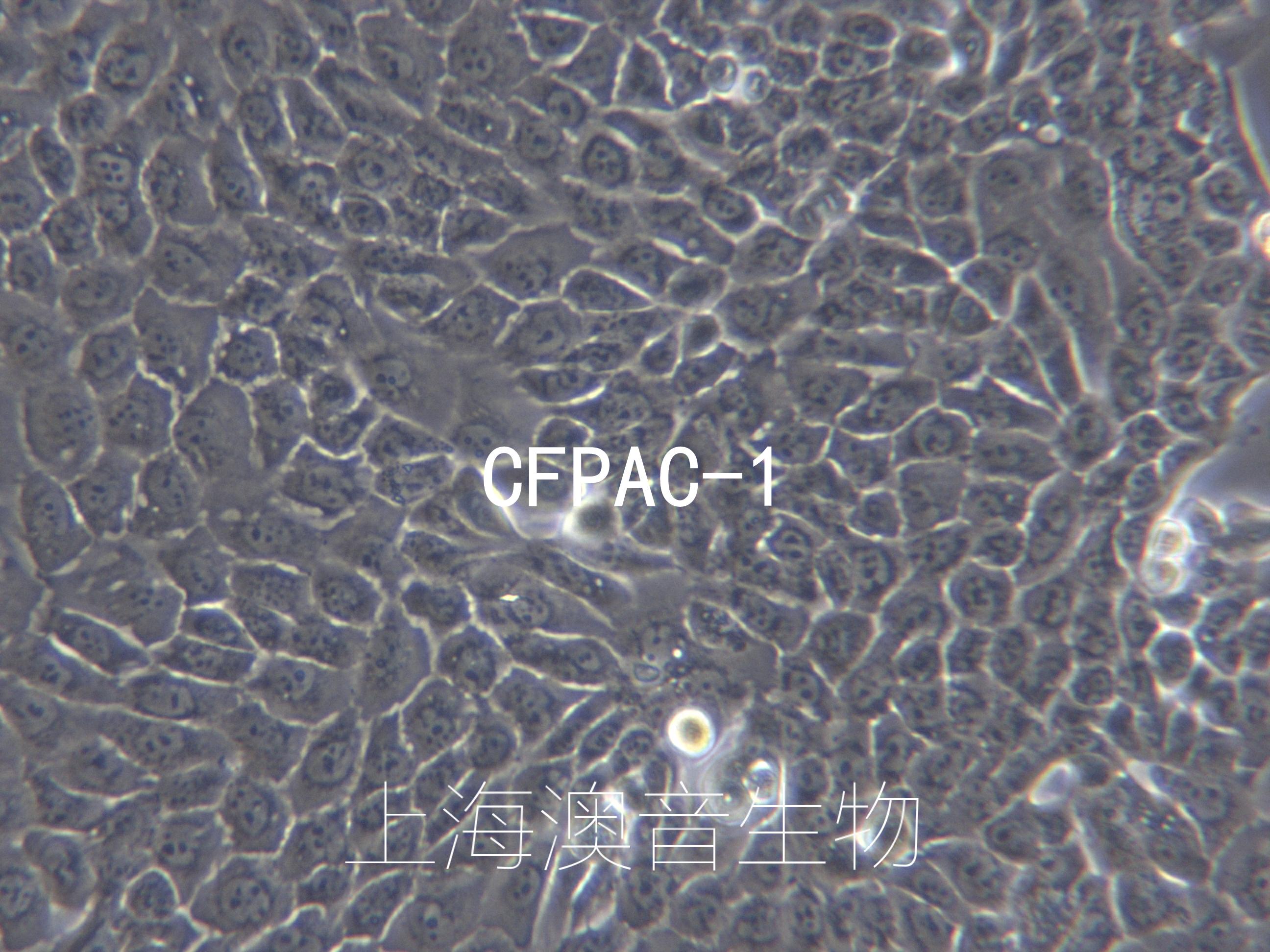 CFPAC-1[ CFPac-1; CF PAC-1; CF-PAC1; CF-Pac1; CF Pac1; CFPAC1; CFPAC]胰腺 ...
