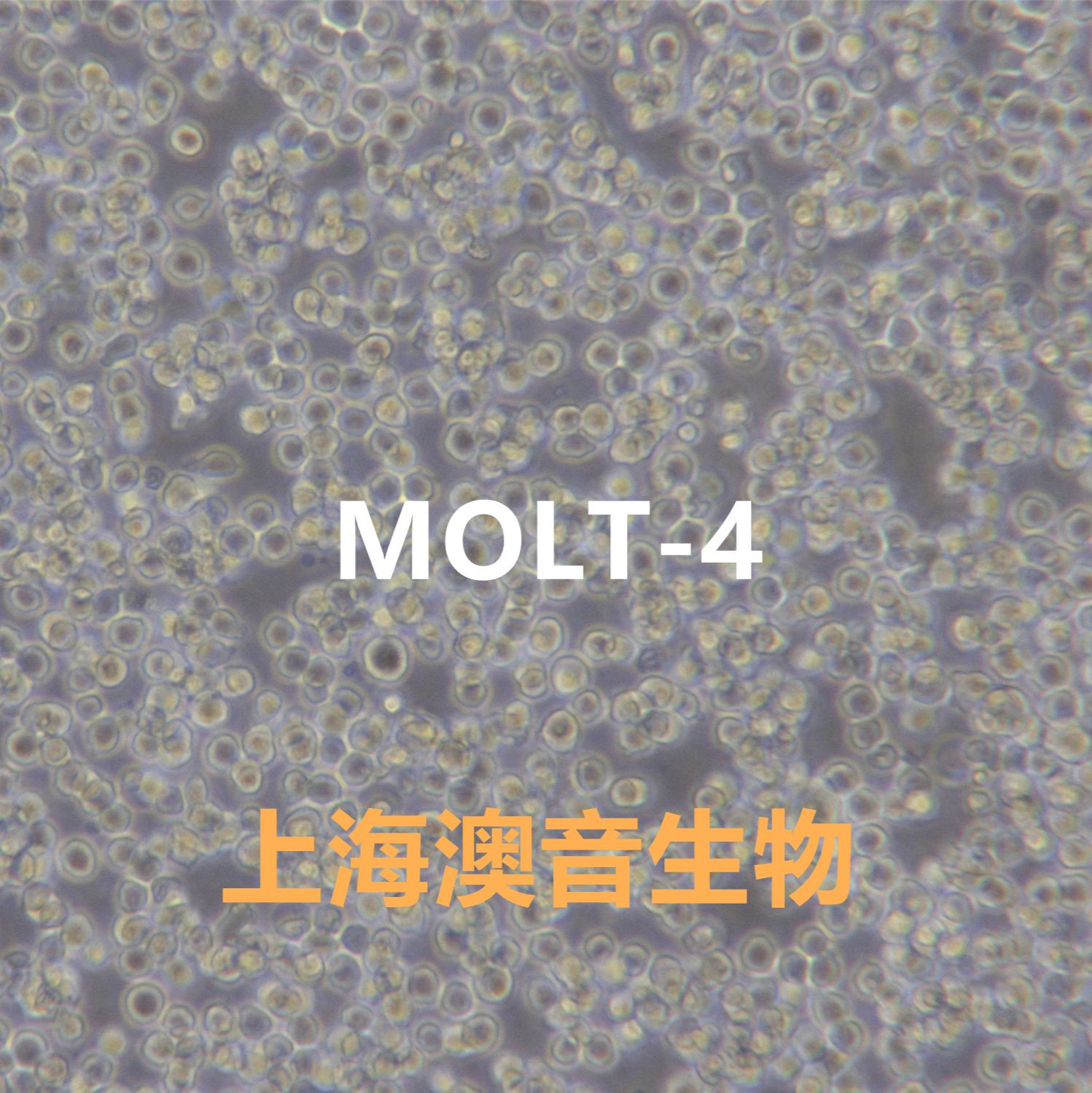 MOLT-4[Molt-4; MOLT 4; Molt 4; MOLT.4; MOLT4; Molt4; GM02219; GM02219C; GM2219C; GM02219D]急性淋巴母细胞白血病细胞