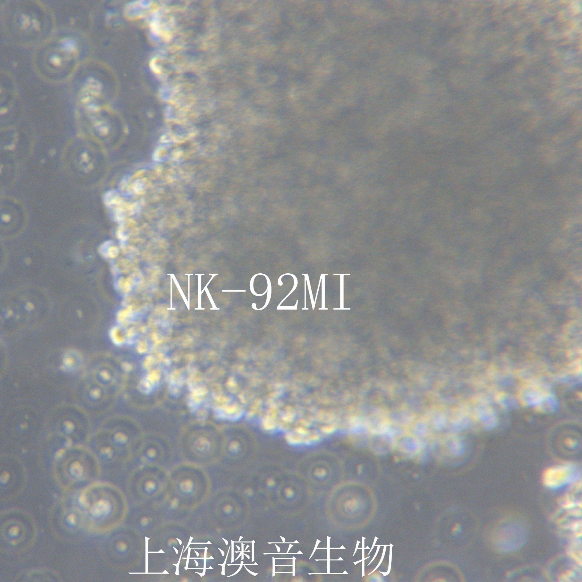 NK-92MI [NK-92 MI; NK-92 mi; NK92-MI; NK92MI; NK-92 transfected with MFG-hIL2]人恶性非霍奇金淋巴瘤患者的自然杀伤细胞
